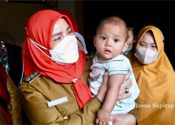Eva Dwiana Bantu Pengobatan Bayi Lahir Tanpa Anus